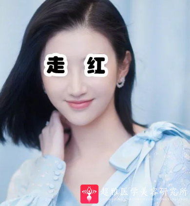 隆鼻手术