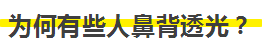 隆鼻手术