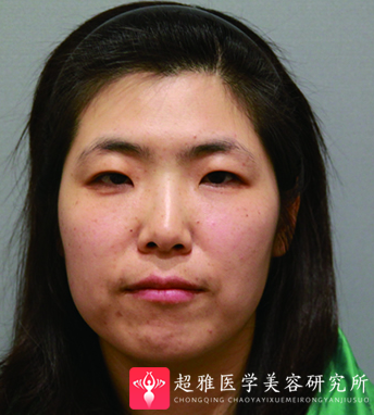 超级微拉美