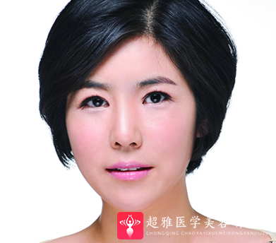 超级微拉美