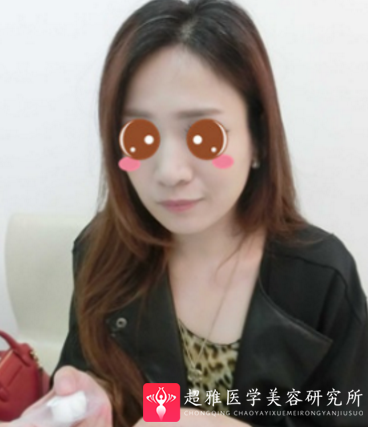 下巴延长术