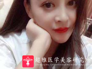 鼻综合整形术