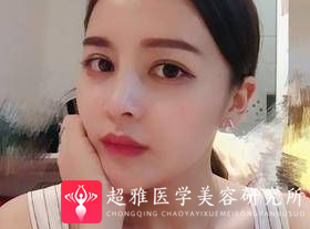 鼻综合整形术
