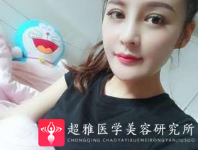 鼻综合整形术