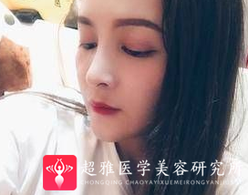 鼻综合整形术