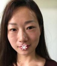 自体脂肪填充