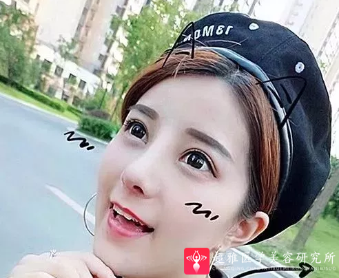 鼻综合整形术