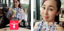 面部提升术