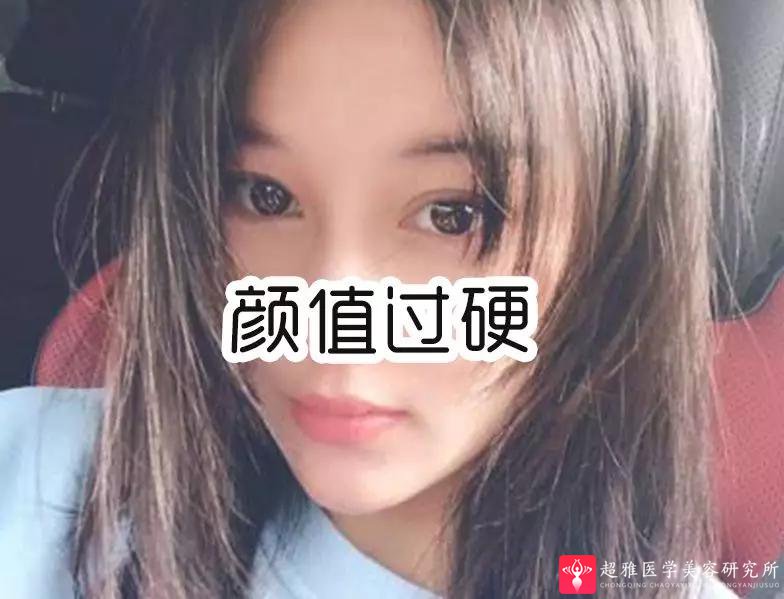 超声波瘦脸