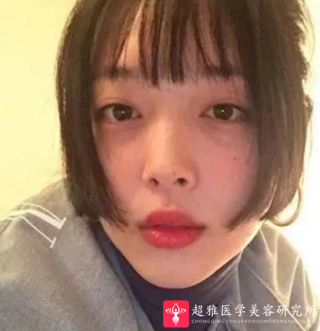 瘦脸方法