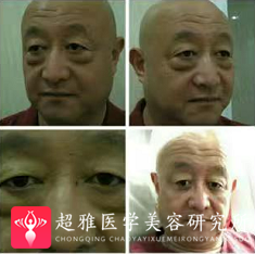 重庆超雅