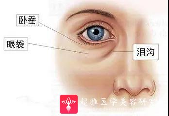 玻尿酸填充术