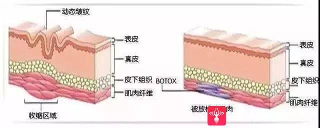 瘦脸方法