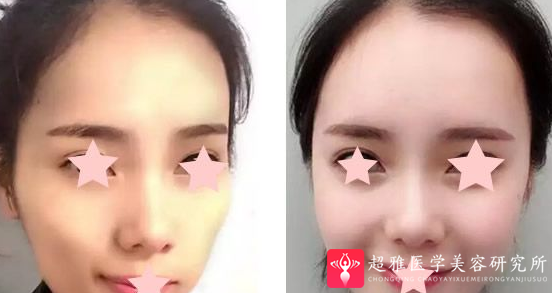 重庆超雅