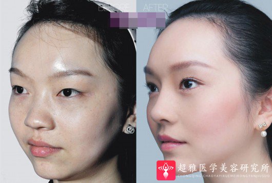 重庆超雅
