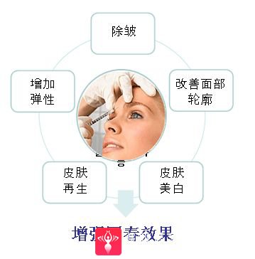 面部提升术
