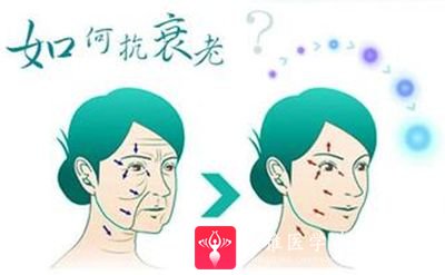 面部提升术