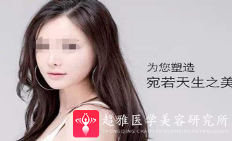 重庆超雅