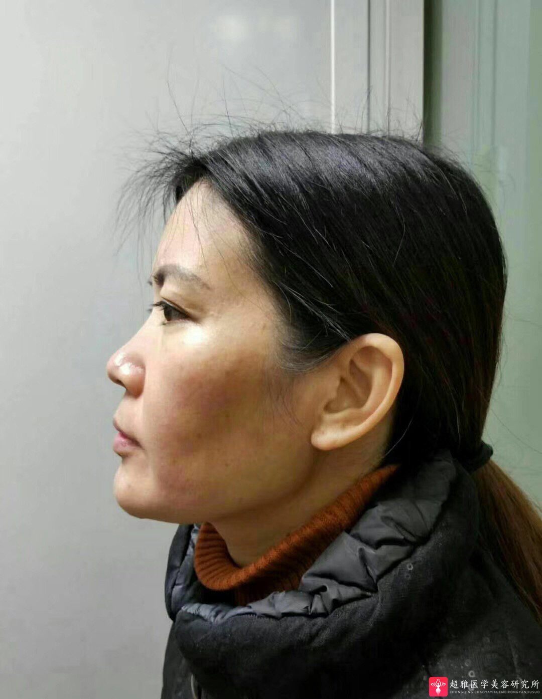 彭氏童颜术
