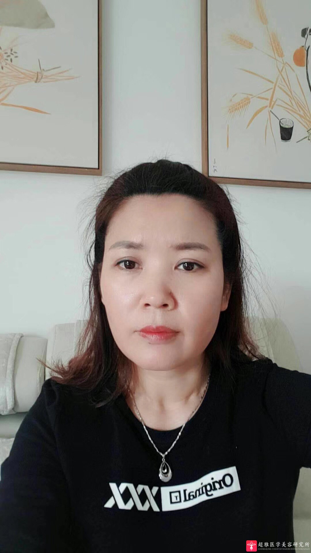 彭氏童颜术