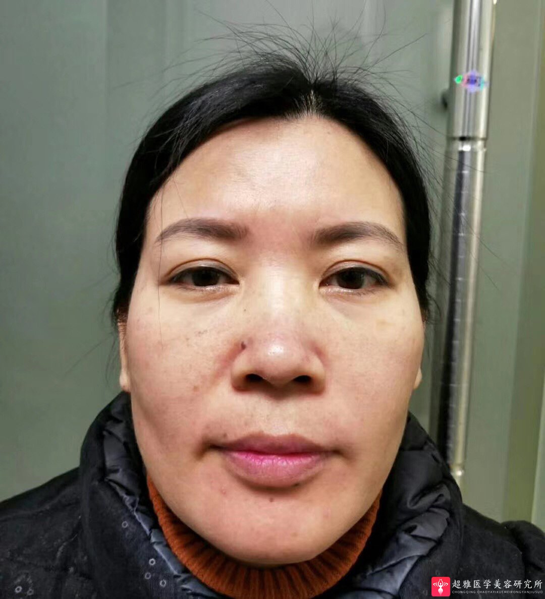 彭氏童颜术