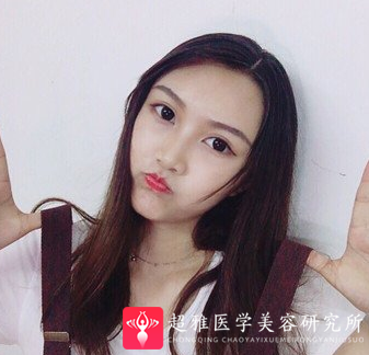自体脂肪填充术