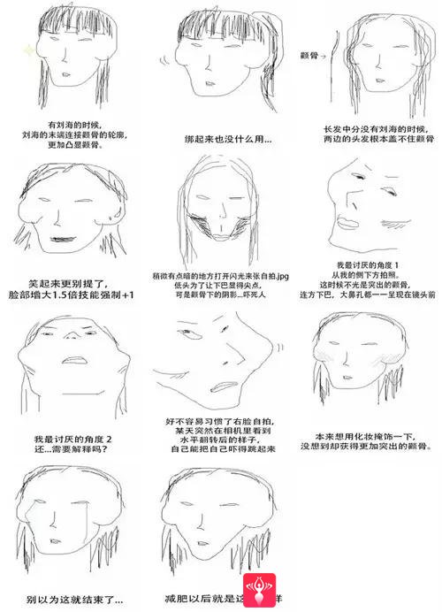 自体脂肪填充术