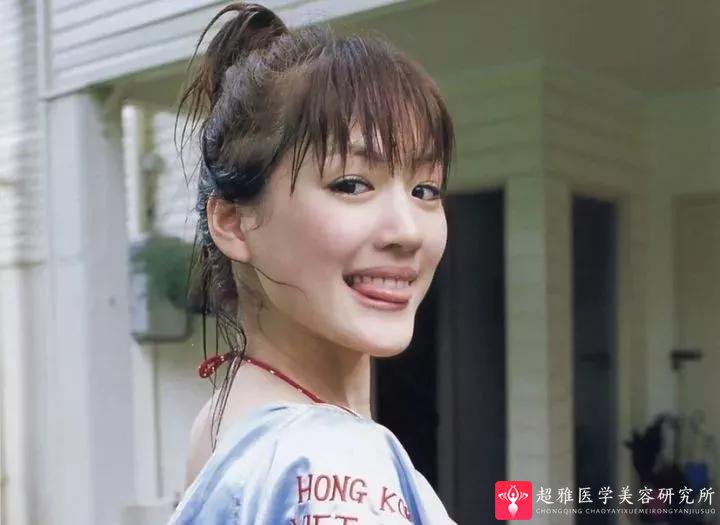 自体脂肪填充术