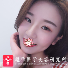 自体脂肪填充术