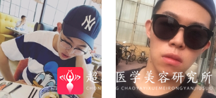 超声波瘦脸