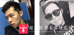 超声波瘦脸