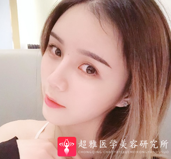 自体脂肪填充术