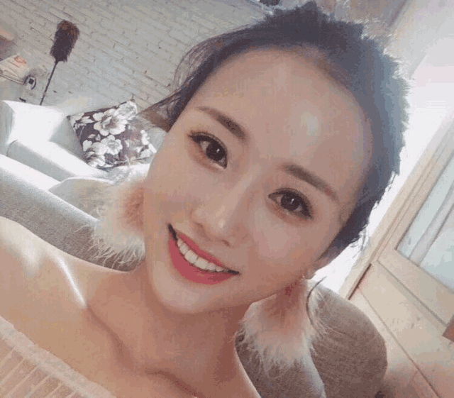 自体脂肪填充术