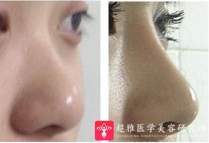 重庆超雅