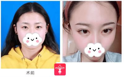 重庆超雅