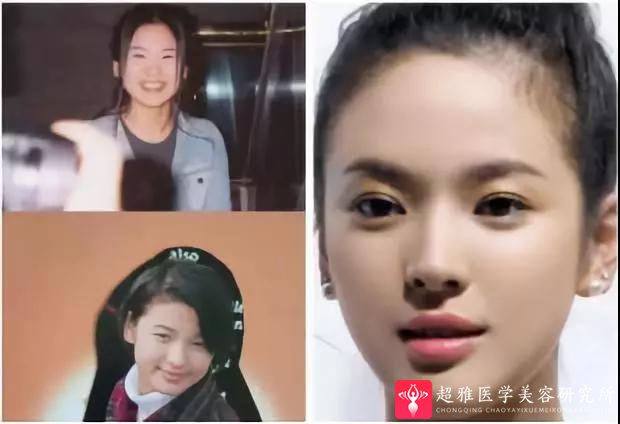 重庆超雅