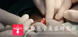 隆鼻手术