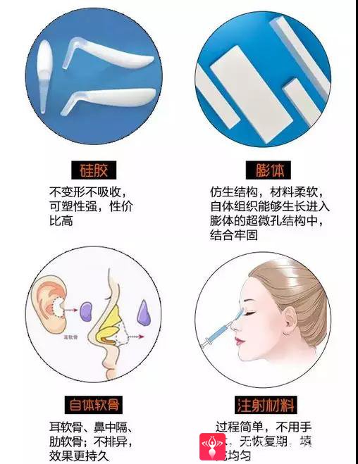 隆鼻手术