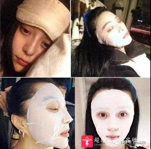 面部提升术