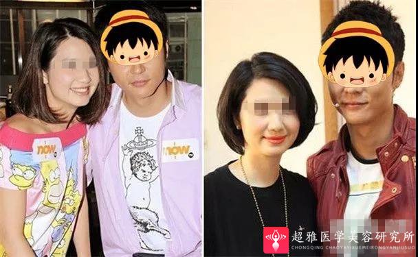 超级微拉美