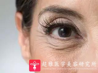 双眼皮手术