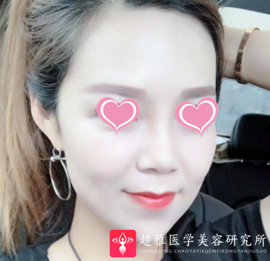 超声波瘦脸