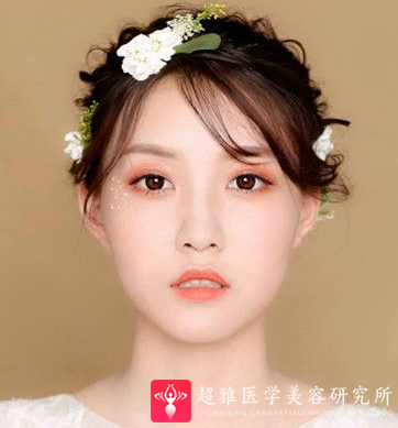 隆鼻手术