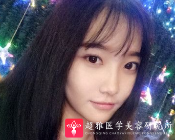 隆鼻手术