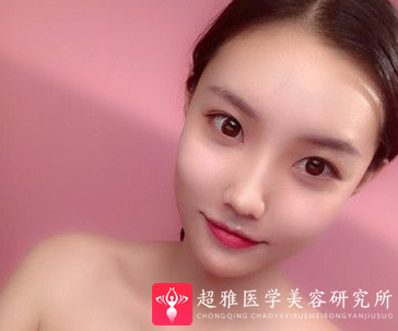 隆鼻手术