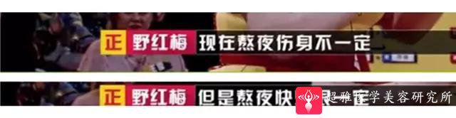 面部提升术