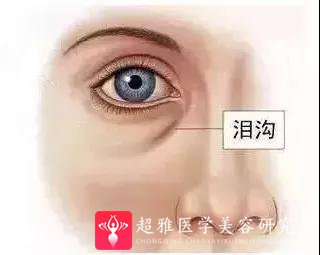 眼袋