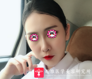 超声波瘦脸