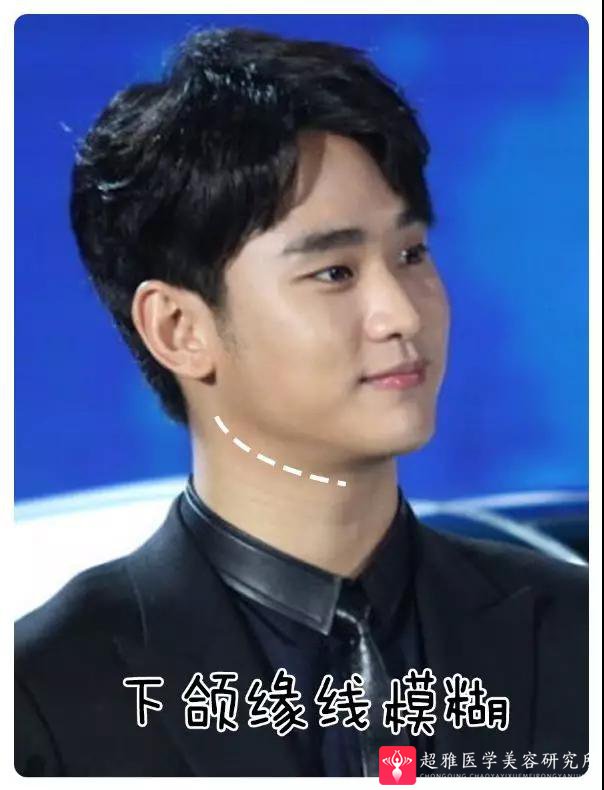超声波瘦脸
