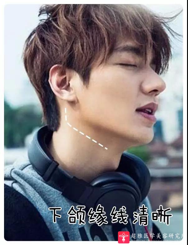 超声波瘦脸